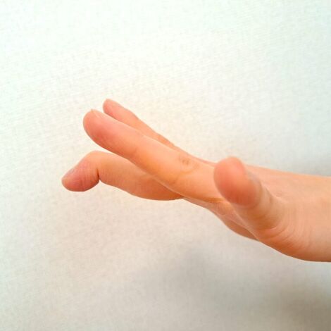 マレットフィンガー