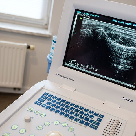 エコー検査