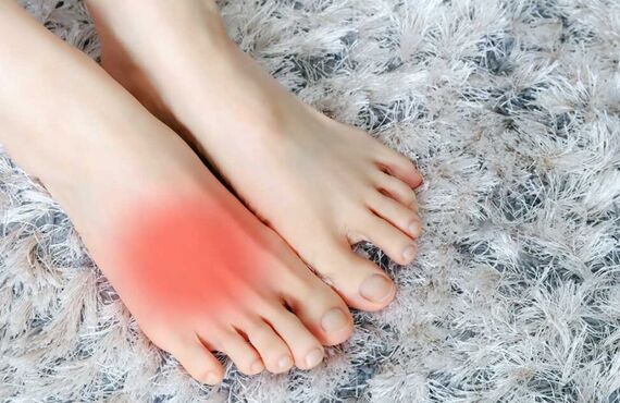 中足骨疲労骨折｜宗像市 はりきゅう整骨院 K MEDICAL